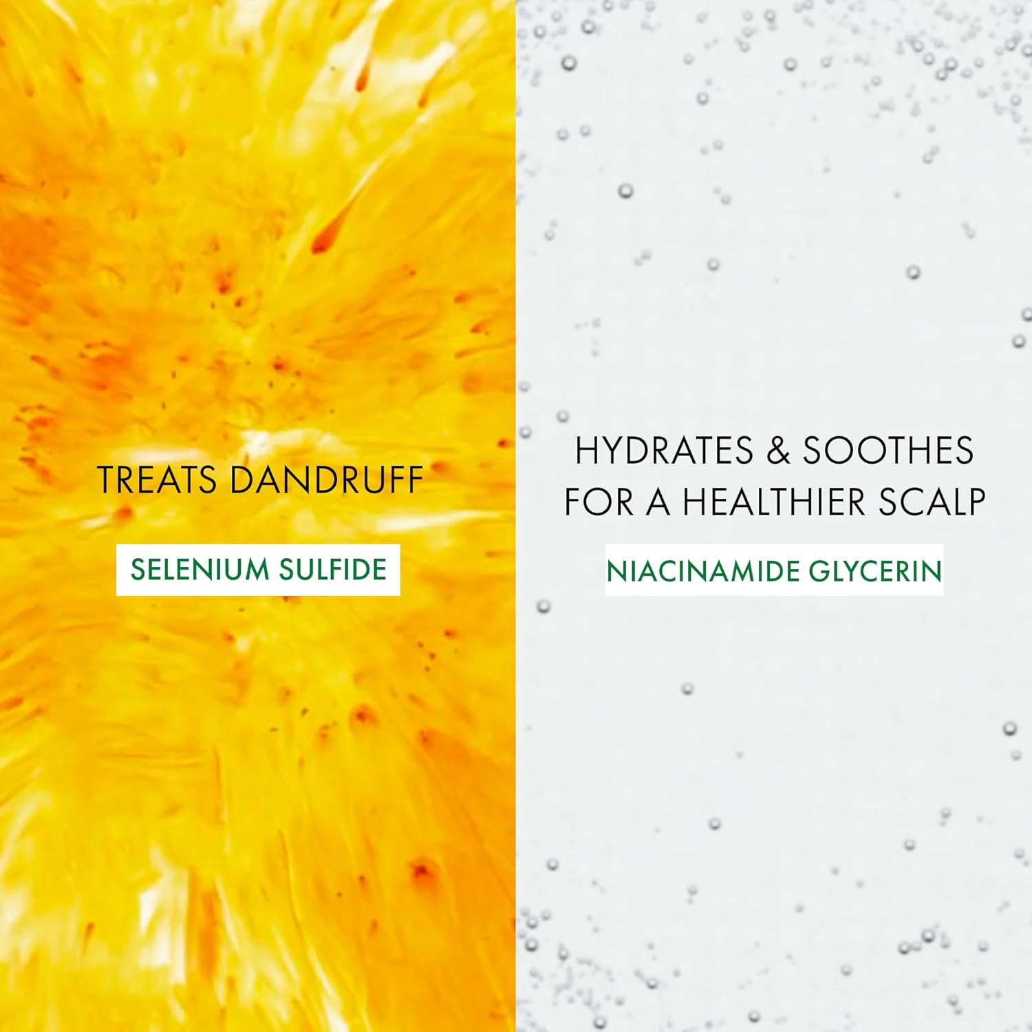 Selenium sulfide dandruff treatment results