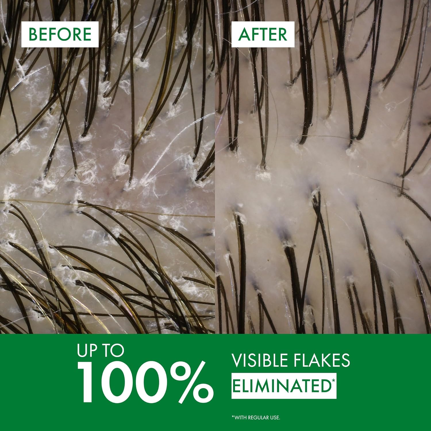 Anti-dandruff shampoo application instructions